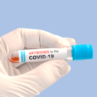 Antibodi COVID-19 Antibodi COVID-19