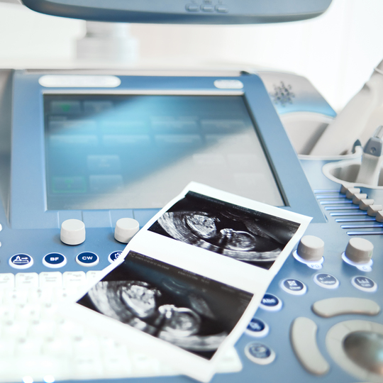 USG Kehamilan 3D HD Live