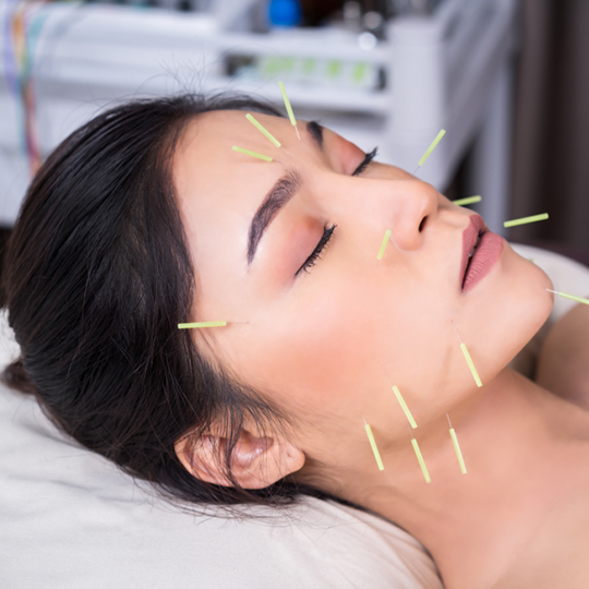 Tanam Benang & Akupuntur