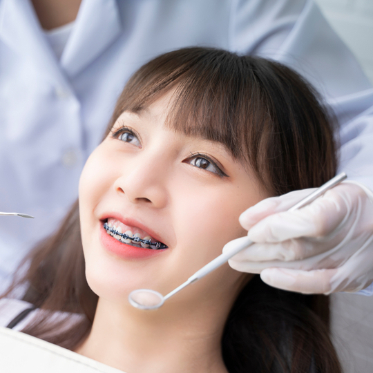 Pemasangan Behel Damon All Clear dengan Spesialis Ortodonti