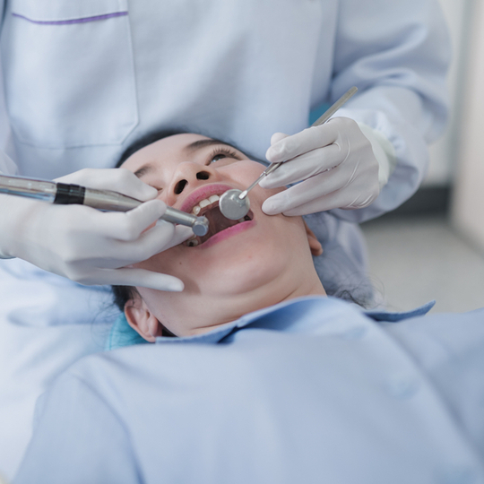 Fiber Post with Core Build Up