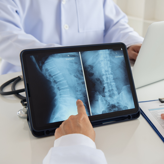 DELETED-Rontgen Vertebra/Tulang Belakang