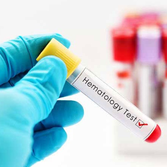 Pemeriksaan Mcv/Mch/Mchc