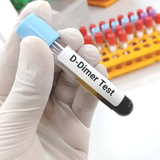 Tes D-Dimer