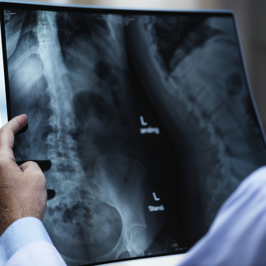 Abdomen (BOF) X-Ray 3 Posisi