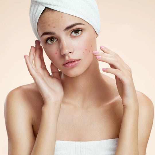 Aura Signature Acne Facial