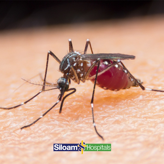 Pemeriksaan Dengue Duo (Antigen & Antibody)